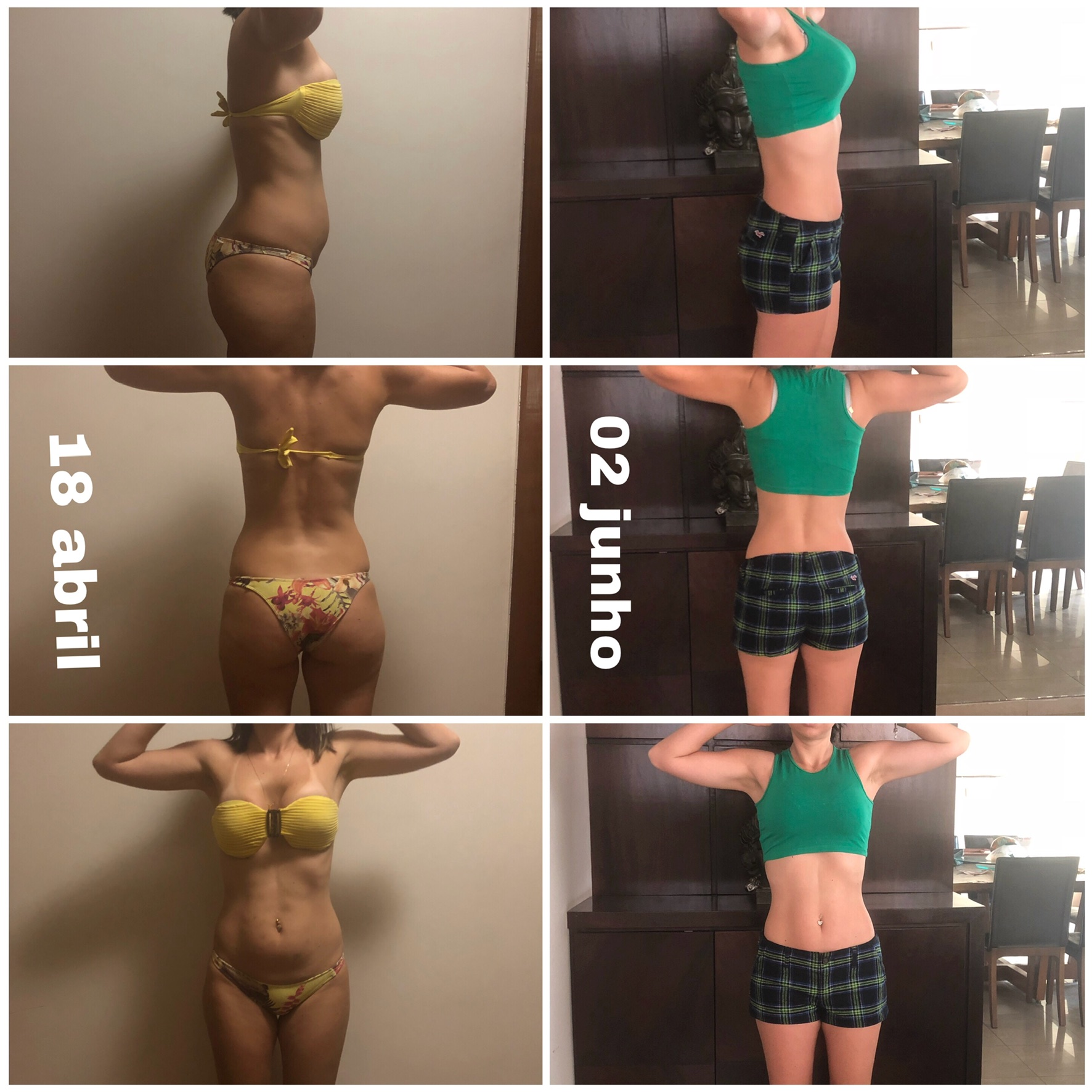 Lipo sem cortes com aplicação ativos